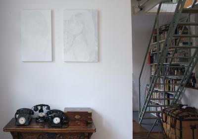 C'est quoi déjà le prénom d'Alzheimer ?